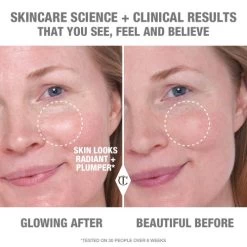 CHARLOTTE’S SPA-LIKE RADIANCE SKINCARE SET 15 CHARLOTTE’S SPA-LIKE RADIANCE SKINCARE SET -Fashion Cosmetics Shop CollagenOil Model Before After Fair 1