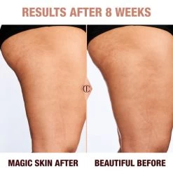 CHARLOTTE'S MAGIC BODY CREAM 15 CHARLOTTE'S MAGIC BODY CREAM -Fashion Cosmetics Shop MagicBodyCream BeforeAndAfter 8weeks Teajuana